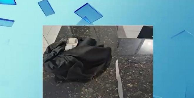Mulher é supostamente agredida pelo ex-companheiro em Barra do Corda