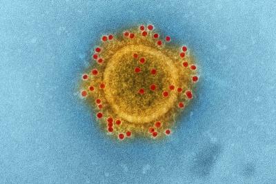 Coronavírus: MA tem mais de 112 mil casos confirmados