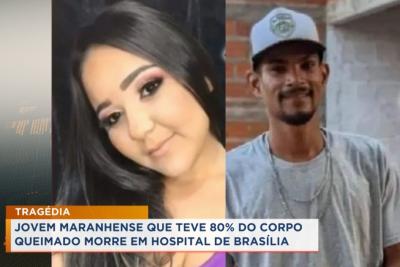 Jovem maranhense que teve 80% do corpo queimado morre em hospital