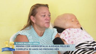 Menina com hidrocefalia ajudada pelo Balanço Geral completa 30 anos