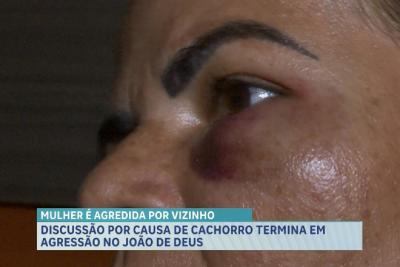 Mulher é supostamente agredida por vizinho após discussão no bairro João de Deus, em São Luís