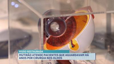 Hospital Universitário da UFMA promove mutirão de cirurgias oftalmológicas na capital