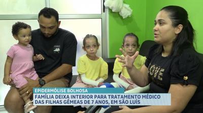 Família deixa interior do MA para tratamento médico de gêmeas de 7 anos, em São Luís