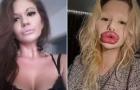 Mulher com ‘maiores lábios do mundo’ diz que dentistas recusam atendimento