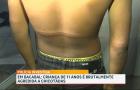 Criança de 11 anos é agredida com chicotada em Bacabal